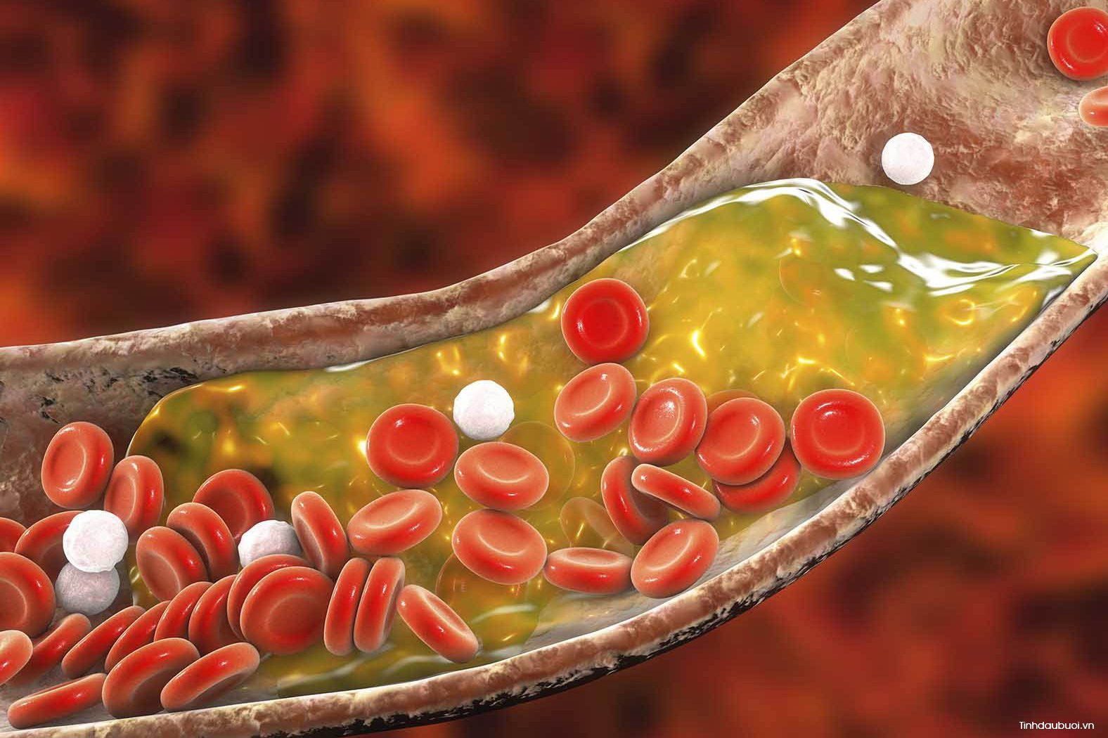 hoa dau biec giup giam cholesterol xau
