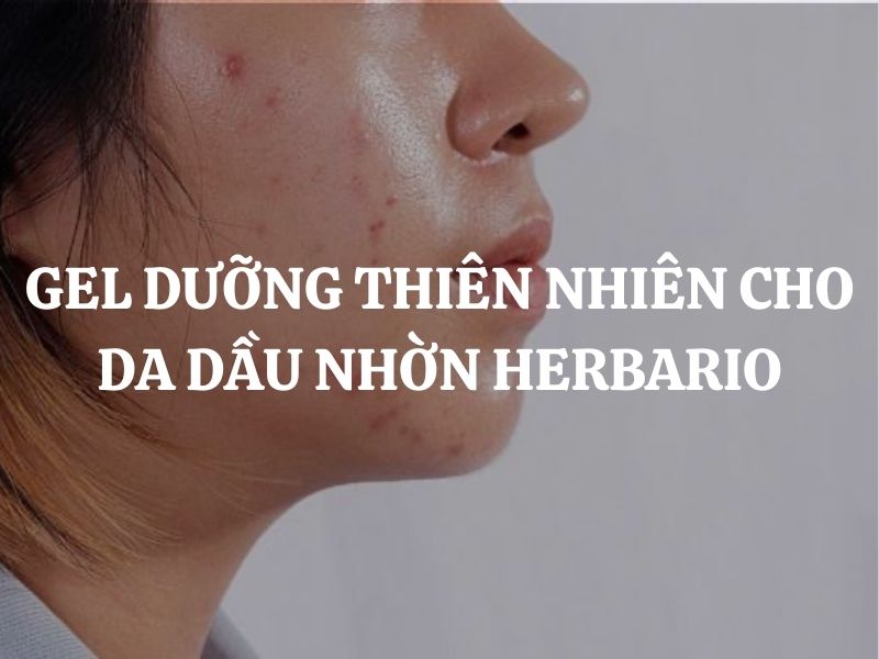 Gel dưỡng thiên nhiên cho da dầu nhờn Herbario: Giải pháp cân bằng & giảm mụn toàn diện