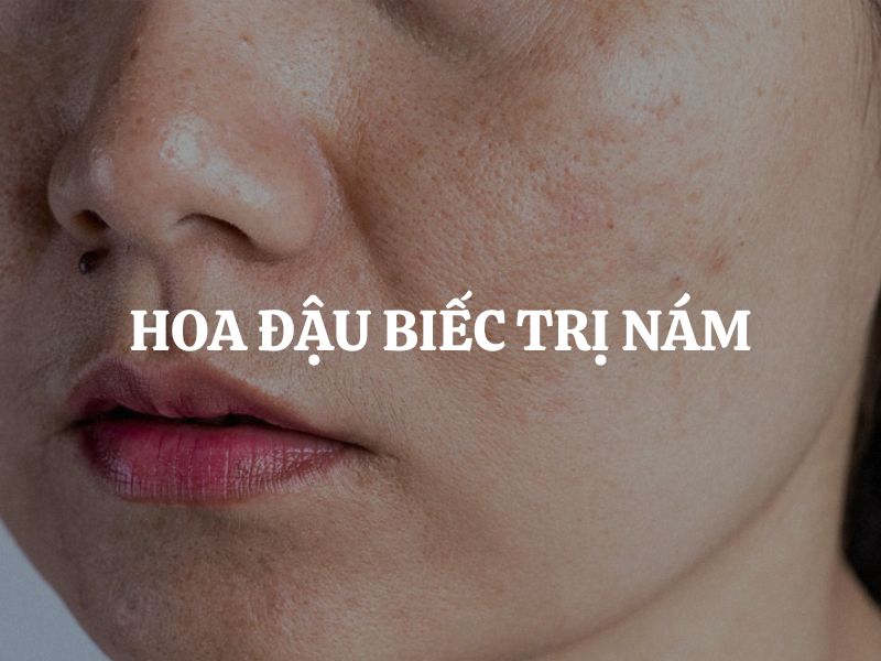 Hoa đậu biếc trị nám có hiệu quả không, thực hư như thế nào?